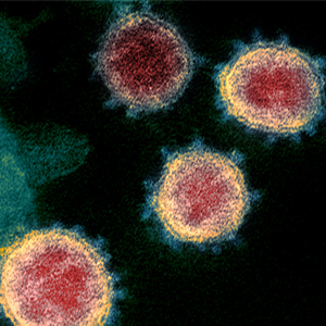SARS-CoV-2 virus particles emerging from cells